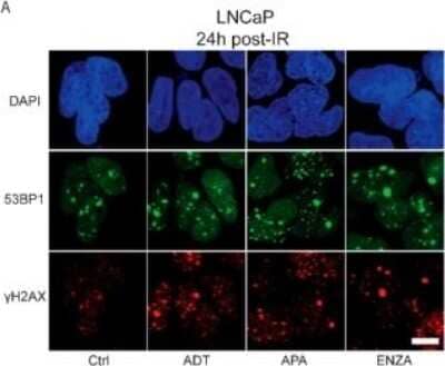 Immunocytochemistry/ Immunofluorescence: 53BP1 Antibody - BSA Free [NB100-904]
